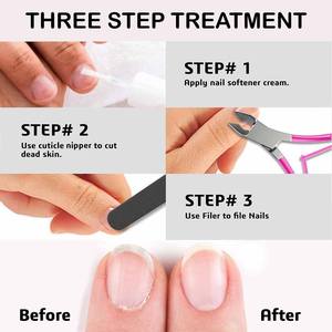 Coupe-ongles pour cuticules en acier inoxydable, coupe-ongles pour les doigts et les orteils, coupe-ongles pour les ongles incarnés - Product Image 6