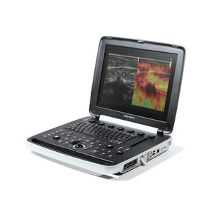 Ecógrafo Samsungg UGEO HM70A - Product Image 5