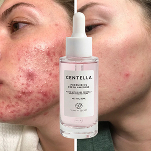 Siero Viso Coreano Anti-Età all'Ingrosso con Centella Asiatica: Essenza Nutriente, Riparatrice e Idratante - Product Image 1