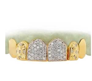 Couleur blanche Grillz personnalisée et poussière de diamant, coupe diamant, Hip Hop Grillz personnalisé, argent sterling Grillz 925, or 10K 14K - Product Image 1