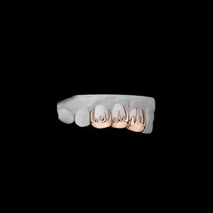 Ensemble de grillz en or rose fait main avec motif de flamme personnalisé, motif de feu sur les dents supérieures et inférieures, embout buccal hip-hop pour hommes et femmes - Product Image 6