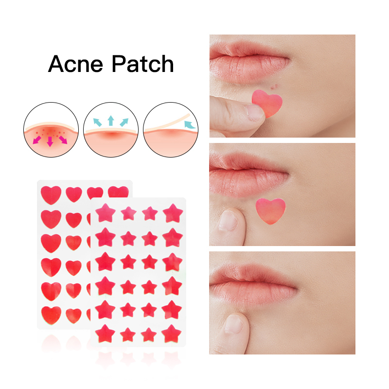 Patch hydrocolloïde de marque de distributeur pour l'acné et le visage, étoile, bouton de guérison OEM