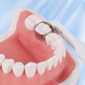 Herramienta Dental, Matriz de Banda, Sistema de Anillo Ajustable de Acero Inoxidable Estándar con Mango, Multiusos para Blanqueamiento Dental - Product Image 3