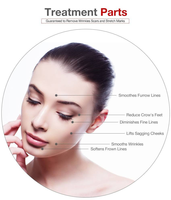 Professionnel Titane 540 Derma Roller Micro Aiguille Dermaroller pour Corps Visage Barbe & Cheveux Beauté & Produit De Soins Personnels