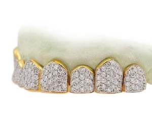 VVS Moissanite Ensemble de lunettes en argent sterling 925 plaqué or 14 carats Fine Grillz Diamond Inspired 8x8 Jewelry - Product Image 3