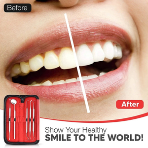 Instrumentos quirúrgicos dentales Kit de examen dental Premium Juego de herramientas de Limpieza de dientes de acero inoxidable Sonda de espejo escalador - Product Image 3
