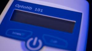 ANALIZADOR DE HEMOGLOBINA Clase II para Desinfección con Alcohol - Product Image 4