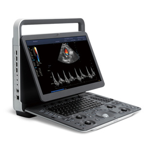 SonoScape E2 ProV Sistema de Ultrasonido Doppler Color Veterinario Portátil con Una Sonda, Escáner de Ultrasonido E2 Pro, Precio de Distribuidor - Product Image 1