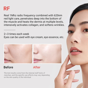 Trẻ hóa da Thiết bị chống lão hóa da mặt săn chắc Massager chống nếp nhăn Máy chăm sóc da mặt nâng Massager - Product Image 3