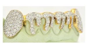 Joyería Dental de Lujo Personalizada para Regalo de Compromiso, Grillz de Plata de Ley 925 con Diamantes de Moissanita y Polvo de Diamante - Product Image 3