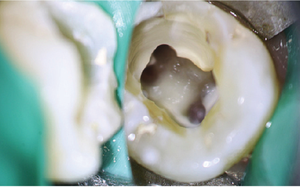 BestScope는 LED 조명, 5 단계 줌, 인체공학적 디자인을 갖춘 고성능 치과 외과 현미경을 BOM-350. - Product Image 5