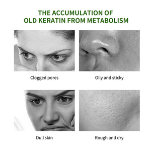 Gel Esfoliante all'Aloe Vera Idratante Nutriente Ammorbidente Rimozione Pelle Morta Viso e Corpo Tutti <span class=keywords><strong>i</strong></span> Tipi di Pelle Pelle Radiosa - Product Image 3