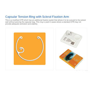 Anneau de tension Capsar de haute qualité avec bras de fixation scléral Instruments d'optique de vente directe d'usine - Product Image 6