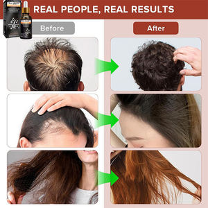 Aceite de Semillas de Calabaza Orgánico Natural en Oferta, Fórmula Redensyl, Suero para el Crecimiento del Cabello Rizado, Bloqueador de DHT, Reparador del Cabello Graso - Product Image 3