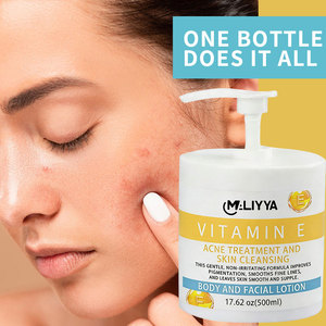 <span class=keywords><strong>Crema</strong></span> Trattamento Acne MALYYA alla Vitamina E 300ml Extra con Burro di Cacao, Idratazione <span class=keywords><strong>48</strong></span> Ore, <span class=keywords><strong>Crema</strong></span> Nutriente Extra OEM/ODM - Product Image 3