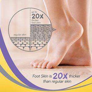 Crème pour les talons fissurés à base d'herbes ayurvédiques Krack Heel Repair, très bien notée, 30g - Product Image 3