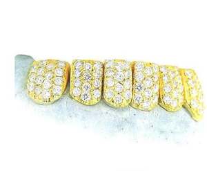 VVS Moissanite 925 Sterling Silver 10K Solid Gold Plated 8x8 Moissanite Diamond Grillz <b>Fine</b> <b>Jewelry</b> - Product Image 3