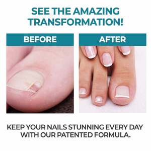 Producto Hidratante para el Cuidado de las Uñas OEM ODM Fábrica Coreana MOQ Bajo - Product Image 3