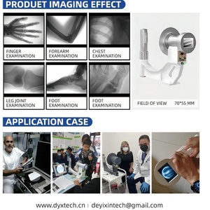 携帯型<span class=keywords><strong>X</strong></span>線装置携帯型蛍光透視装置 - Product Image 2