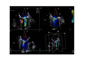 Appareil d'échographie GE Vivid E95 d'occasion - Product Image 5