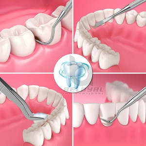 Kit Equival de Implante Dental con Herramientas de Medición para Comparación de Profundidad y Diámetro - Product Image 6