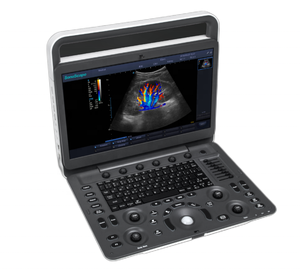 Escáner de Ultrasonido Sonoscape, Doppler Color Cardíaco y Vascular, Sonoscape E2 E3 - Product Image 2