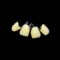 Couronne en zircone de porcelaine E-max à externaliser |   Restaurations dentaires de précision avec technologie E-max et zircone