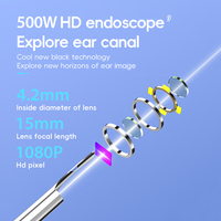 Nettoyeur d'oreilles sans fil portable avec caméra 5MP, visibilité intelligente, Wi-Fi sécurisé, batterie 230 mAh, 45 minutes d'autonomie, gyroscope 3 axes, CE/FCC
