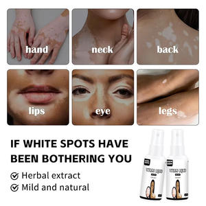 Produsen Grosir Krim Kesehatan <span class=keywords><strong>Vitiligo</strong></span> Produk Perawatan Kulit Bahan Herbal Semprotan Cair <span class=keywords><strong>Vitiligo</strong></span> - Product Image 5