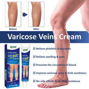 Krim untuk Varises Nyeri Otot Pembengkakan Pereda Ketidaknyamanan Krim Tubuh Penghalus dengan Pijat Pembuluh Darah - Product Image 4