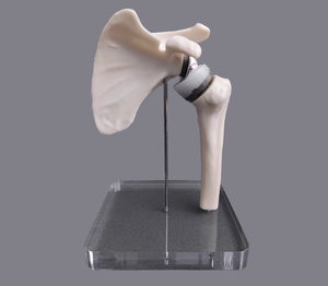 Modelo de Reemplazo de Articulación del Hombro - Modelo de Comunicación Médico-Paciente para Cirujanos Ortopédicos (Versión en Miniatura) - Product Image 5