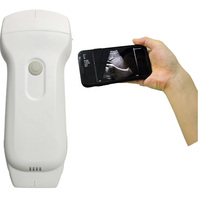 Ecógrafo Doppler Color Portátil Inalámbrico Veterinario 3 en 1 con USB y Wifi, Sonda Convexa y Lineal para Animales