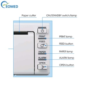 เครื่องพิมพ์ความร้อนดิจิตอลทางการแพทย์ UP-D711MD สำหรับเครื่องอัลตราซาวนด์ - Product Image 6