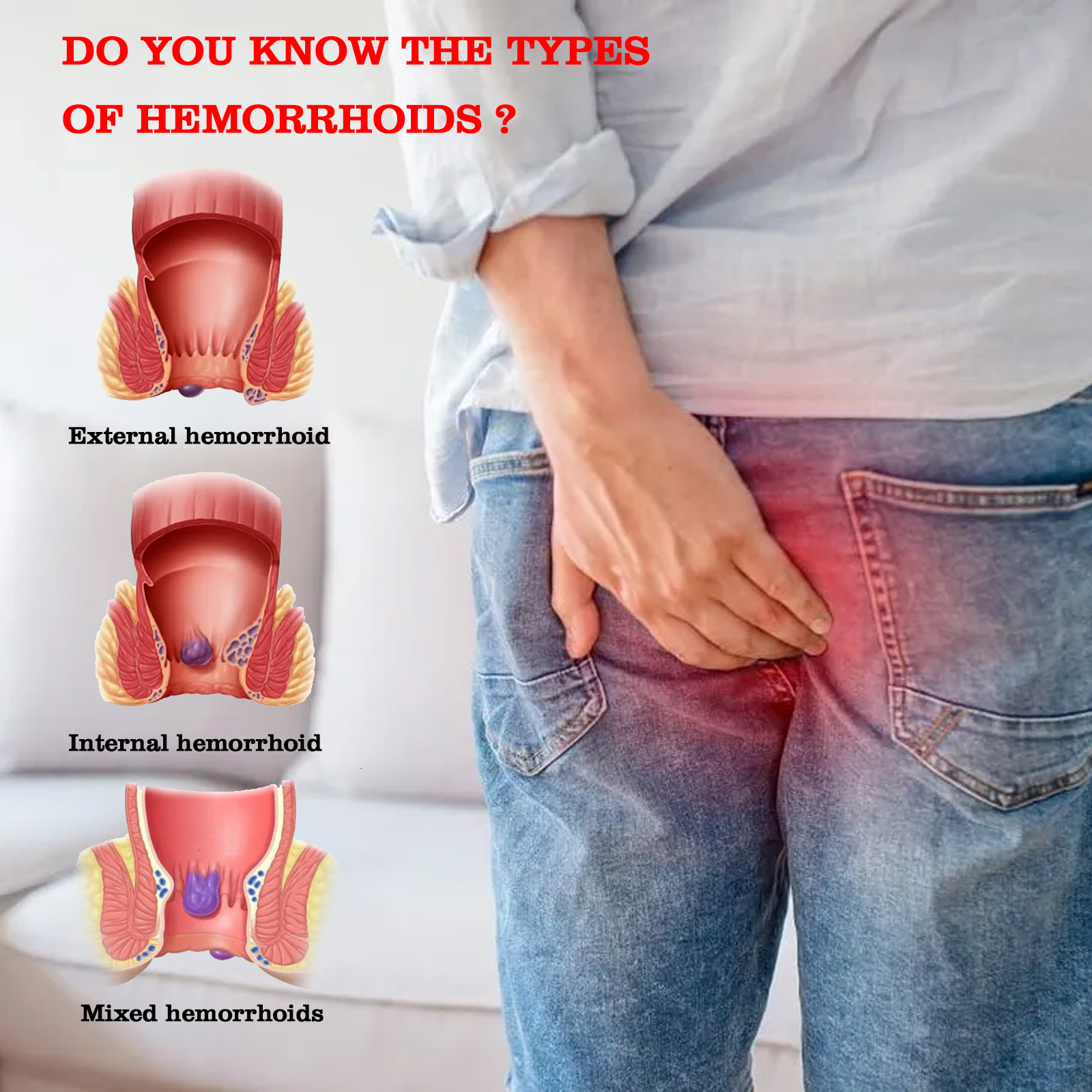 anal fissure treatment hemorrhoid ointment herbal cream natural medicine suppository powerful hemorrhoids cream