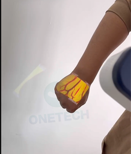 Yüz ameliyatı için VF12 pediatrik kan damarı bulucu/ven dedektörü/taşınabilir damar bulucu - Product Image 4