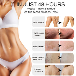 Sérum de rasoir OEM vegan pour hommes, <span class=keywords><strong>hydratant</strong></span>, réduction des taches foncées et redresse, prévention des cheveux et de la barbe, soins, solution anti choc, rasoir, 1 pièce - Product Image 4