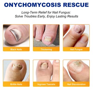Nuevo 2025 Parches de Reparación Nocturna Extra Fuertes de 8 Horas para Uñas de los Pies y de las Manos, para el Renovamiento de Uñas Dañadas - Product Image 5