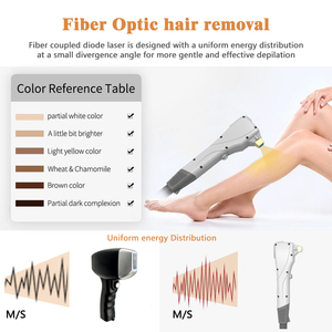 KM Medicina Estética 755 fibra láser 755 808 1064 nm Depilación Láser de fibra sin dolor Weifang con OEM ODM - Product Image 5