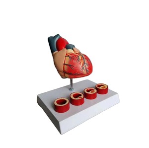 Model penyakit jantung erotis atherosclerotik koroner untuk pelatihan perawat Model penelitian sains medis manusia - Product Image 2