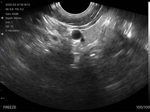 Transvaginal <span class=keywords><strong>Probe</strong></span> Ultrasound nirkabel tunggal, untuk GY OB - Product Image 5