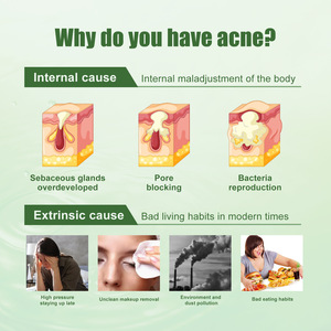 เซาท์มูน แอนตี้-แอคเน่ เฟเชียล เจล ลดรอยสิว ปิดรูขุมขน ทำความสะอาดผิว และปรับสภาพผิวที่มีปัญหา<span class=keywords><strong>สิว</strong></span> 30 มล. - Product Image 6