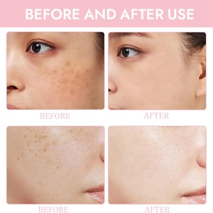 Etiqueta privada personalizada Pink Peptide 12 PDRN Serum Skin Glow Hidratante Reafirmante Niacinamida Face Dark Spot Removal Serum - Product Image 4