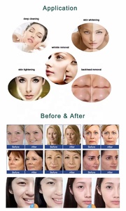 Jetpeel-Peeling de oxígeno para la piel, Aqua Peeling, Aqua Peeling, hidratante, Limpieza Profunda, cuidado Facial, Insrtument H3 - Product Image 5