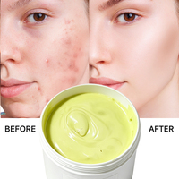 Crème anti-acné à base de plantes en vrac pour fabricants, 1 kg – Crème hydratante professionnelle anti-acné pour salons et marques de soins de la peau
