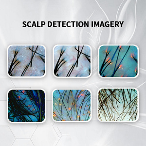 Facial Machine 2023 Ai Technology Smart Skin Analysis Machine - Product Image 5