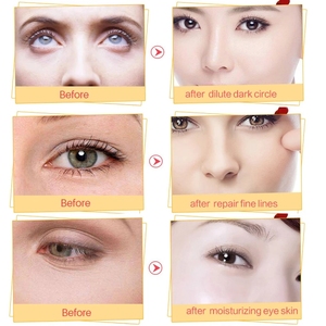 Masque pour les yeux en cristal de collagène Papillon Cercles noirs Enlever les poches Anti-âge Masque pour les yeux anti-rides Soin de la peau - Product Image 4