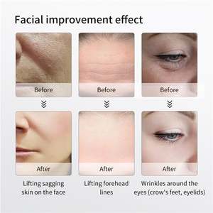 Instrumento de belleza de fotones de melocotón de mano Dispositivo de enfriamiento facial para estiramiento de la piel y tecnología de estiramiento facial antienvejecimiento - Product Image 4