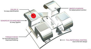 Soporte dental fijo con arco, material <span class=keywords><strong>de</strong></span> alambre para <span class=keywords><strong>dientes</strong></span> <span class=keywords><strong>de</strong></span> ortodoncia, desechable, <span class=keywords><strong>de</strong></span> metal - Product Image 5