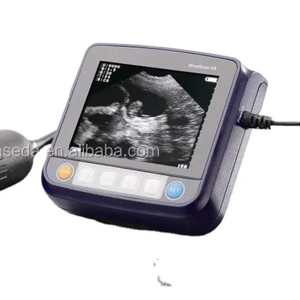 Échographe vétérinaire Animaux de Compagnie <span class=keywords><strong>Portable</strong></span> Pour La Grossesse Animale - Product Image 1