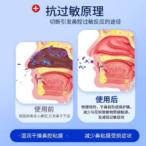 AiHuJia Gel Nasal Antialérgico 20g Hidratante Para Rinitis Alérgica - Product Image 5